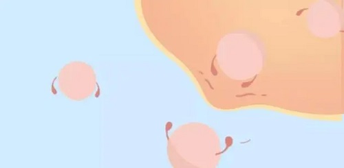 赴泰試管嬰兒助孕需要做好哪些攻略？