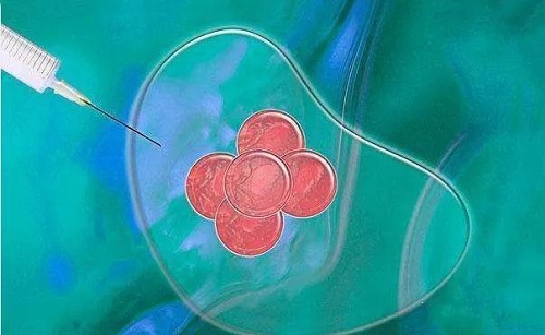 泰國(guó)試管嬰兒存在失敗風(fēng)險(xiǎn)嗎